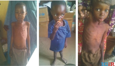 Malnourished children in the camp