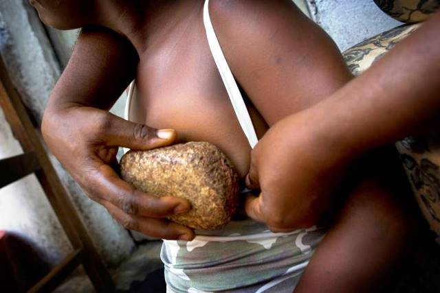 Young girls are made to undergo Breast ironing when they reach puberty to make them sexually unattractive to the opposite sex