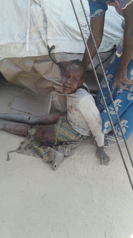 An injured child after the Rann attack
