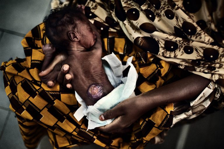 Child and maternal mortality rate in Nigeria is ‘like having 10 plane crashes every day’