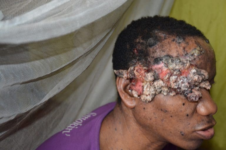 UNDERCOVER INVESTIGATION: Cancer is the disease, Nigeria’s health system is the killer