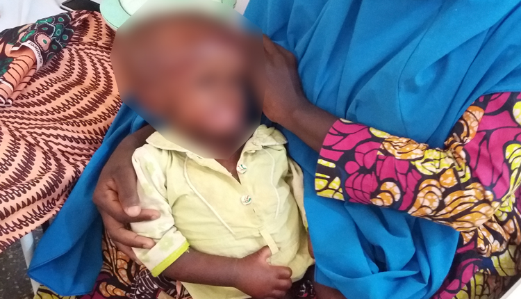 Banditry, malnutrition killing thousands of children in Zamfara