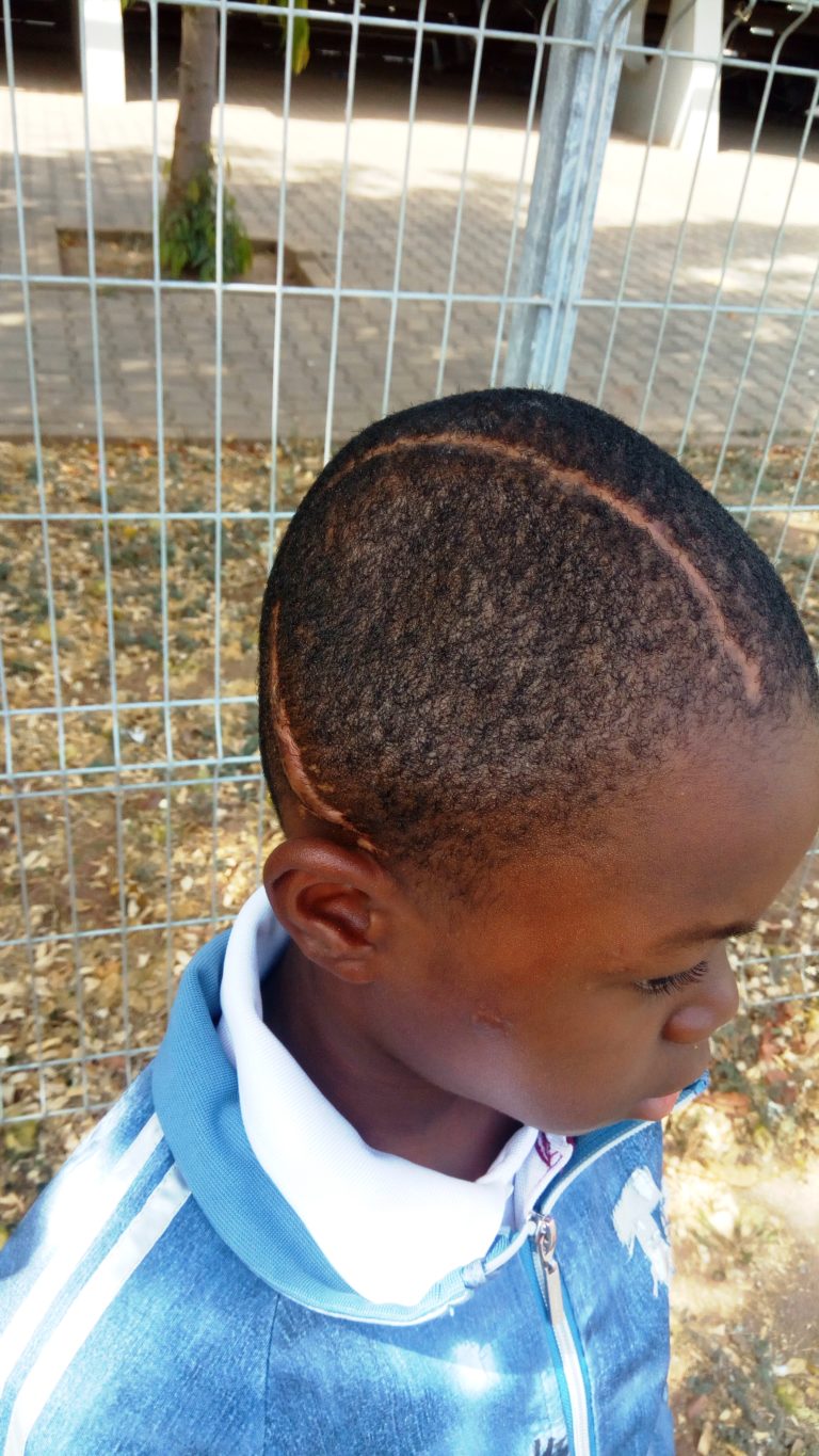 Parents of eight-year-old with broken skull seek help for surgery