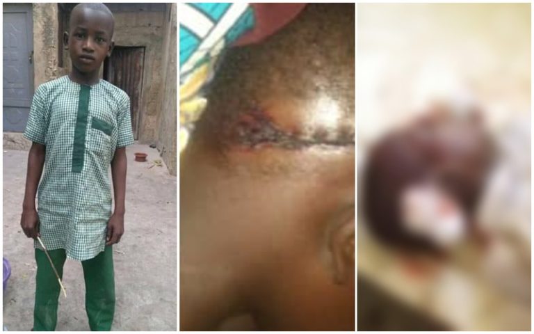 BLOOD ON UNIFORMS (5): 10-year-old aspiring doctor dead after police raid on Jigawa market