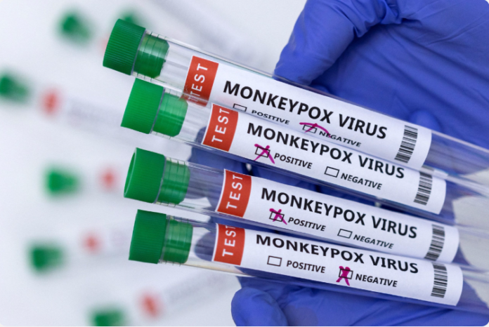 Monkeypox sample