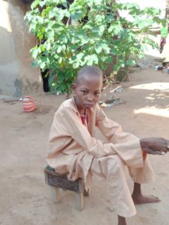 18 Year old Kabiu Malam Sickle Cell Patient