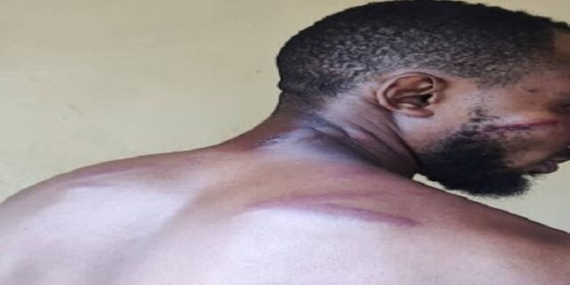Freeman Freeman, A victim of Electoral violence In Lagos during the 2023 governorship election.