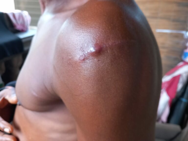 Stabbed, beaten, and fined: Ordeal of a Lagos resident during the 2023 governorship election