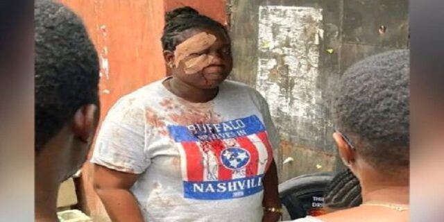 Jennifer Edifi, at her Polling unit after she was attacked courtesy Businessday 