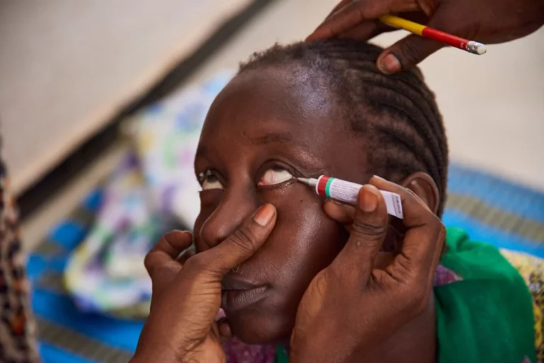 Benin, Mali eliminate trachoma, but Nigeria remains burdened with disease