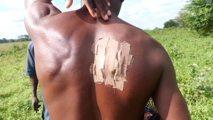 Picture showing a gunshot injury of a Local security personnel tasked with securing Kundu and some other parts of Zungeru.