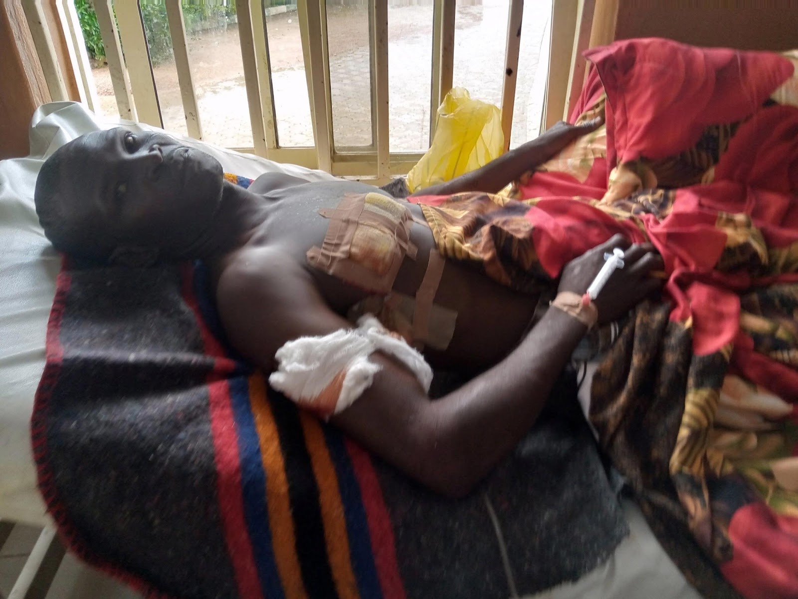 James Danjuma was placed on blood support after he survived seven gun wounds by bandits who waylaid him and his patrol team inside Yankari Game Reserve / Yakubu Mohammed
