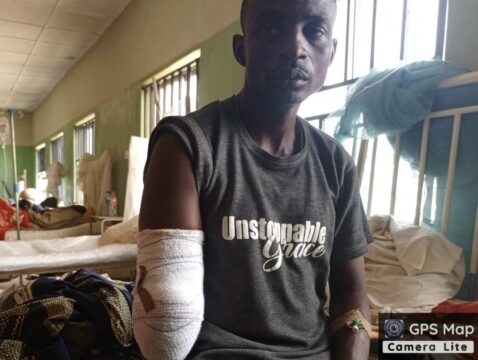 A survivor of the alleged military brutality in the Mangu area, Sunday Yusuf. Photo: Local/The ICIR