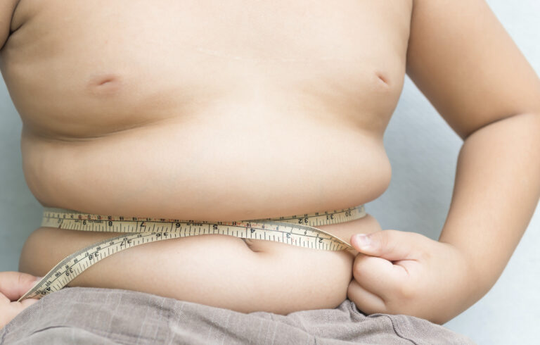 Childhood obesity now main form of malnutrition worldwide – UNICEF
