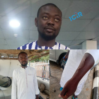 Photo collage of Zakari showing his looks before he was diagnosed with CKD and his current looks. PC: Nanji Nandang/ICIR