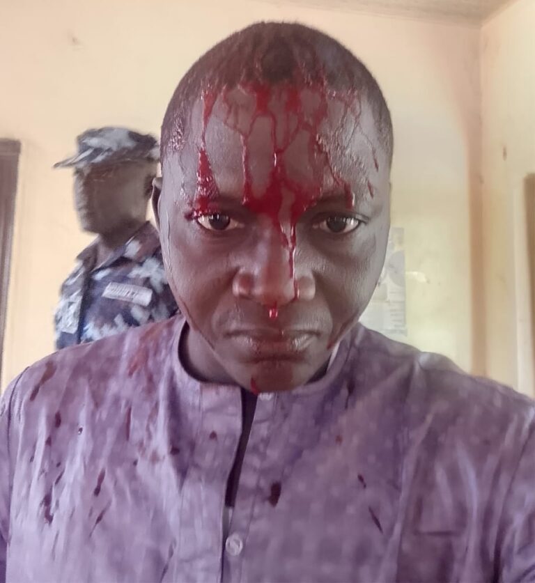 MRA demands probe into journalist ‘attacked by police’ in Bauchi