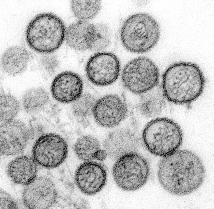 What you should know about hantavirus