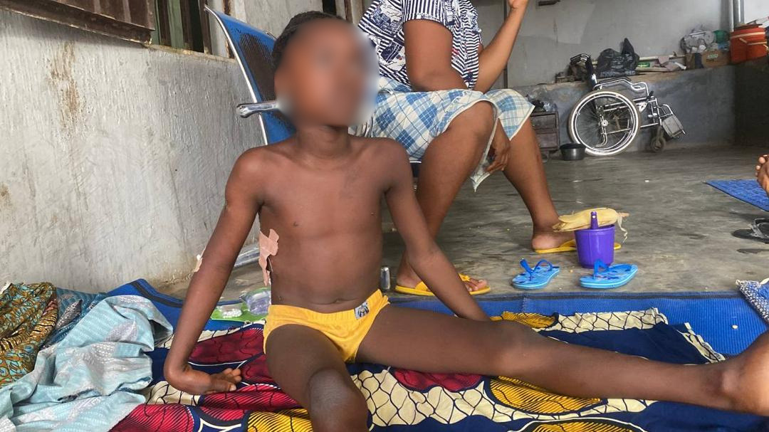 Saitu Emmanuel, a nine-year-old survivor of an accidental airstrike.